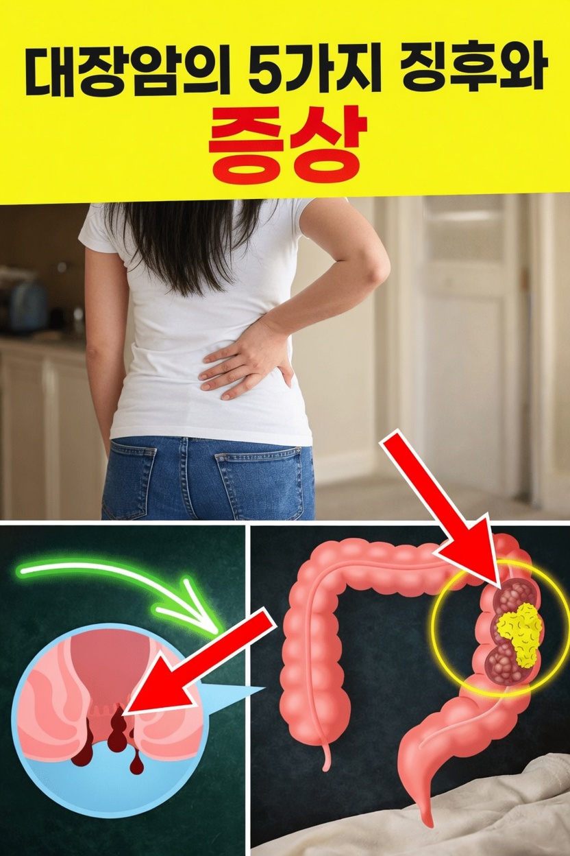 의료진과 상의해야 할 대장암의 흔한 징후와 증상 5가지