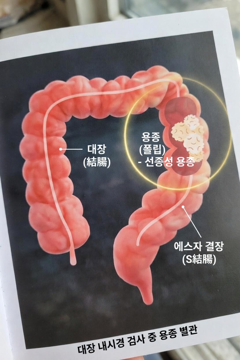 의료진과 상의해야 할 대장암의 흔한 징후와 증상 5가지