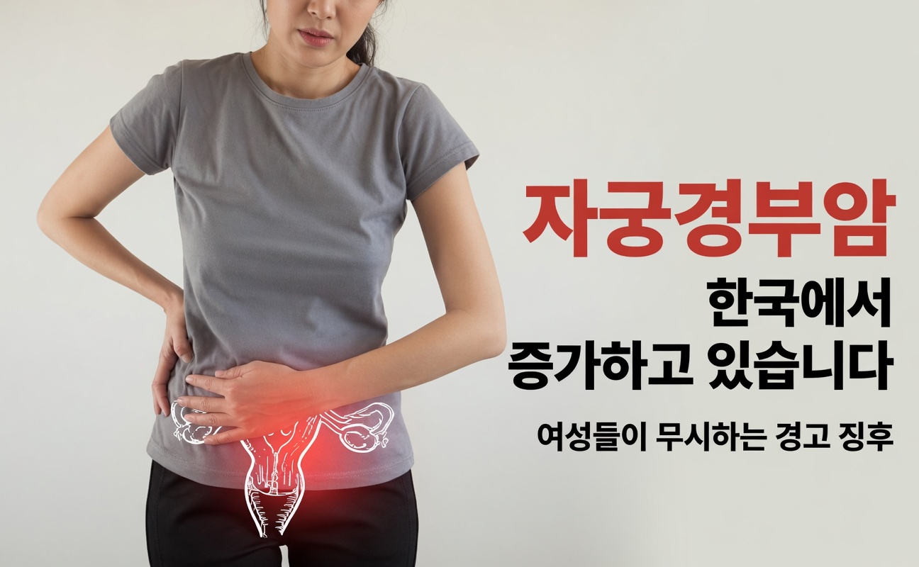 대부분의 여성이 너무 늦을 때까지 무시하는 자궁경부암 초기 경고 신호 9가지