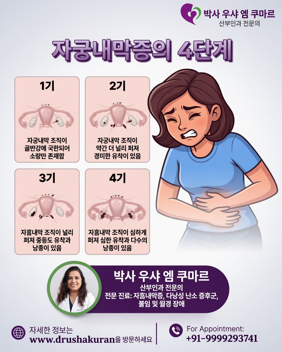 모든 여성이 자궁내막증에 대해 알아야 할 것