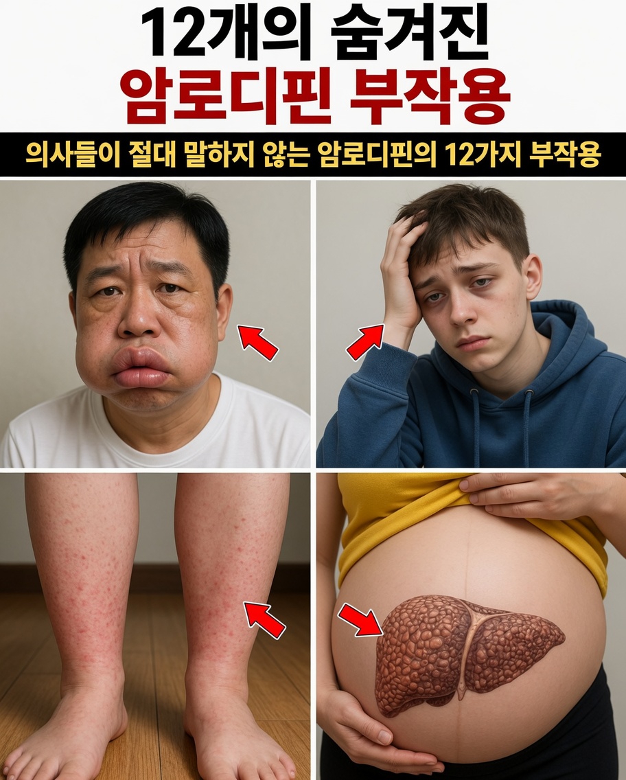 암로디핀의 흔한 부작용 12가지: 더 나은 이해를 위한 완벽 가이드와 예상할 수 있는 사항