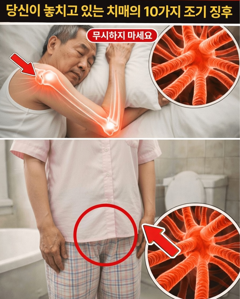 일상생활에서 놓치고 있을지 모르는 치매의 초기 징후 10가지