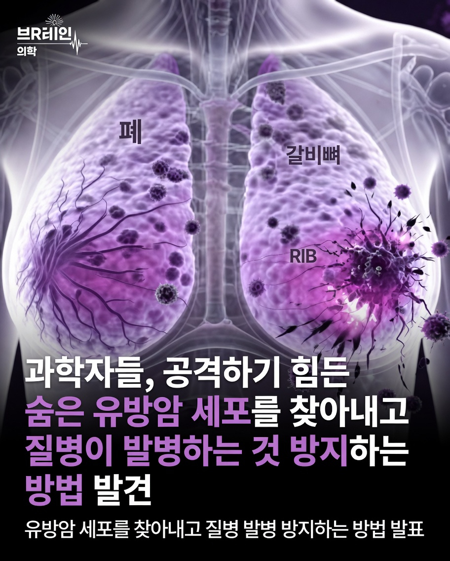 휴면 종양세포 표적치료와 생존자의 유방암 재발에 대해 최근 임상 연구가 밝혀내고 있는 것