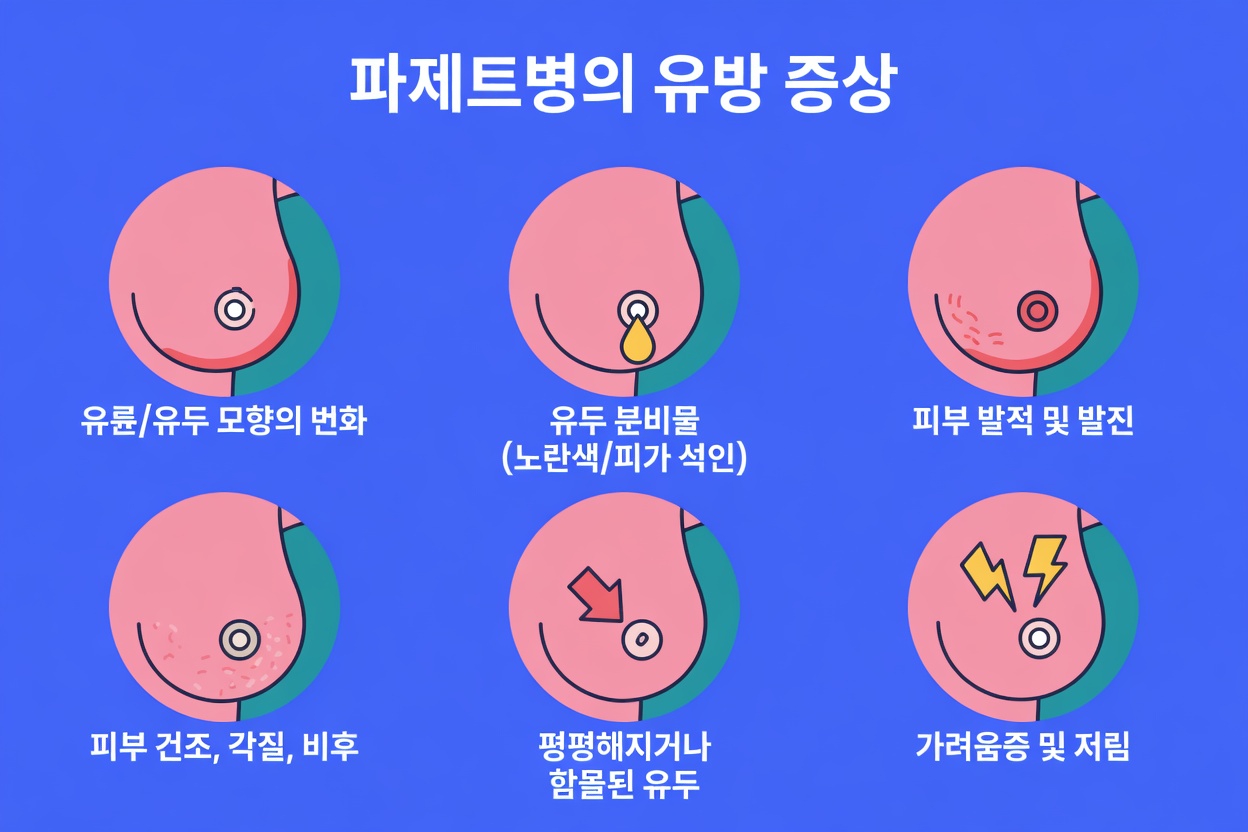 유방암의 초기 경고 신호를 놓치고 있나요? 모든 여성이 알아야 할 것