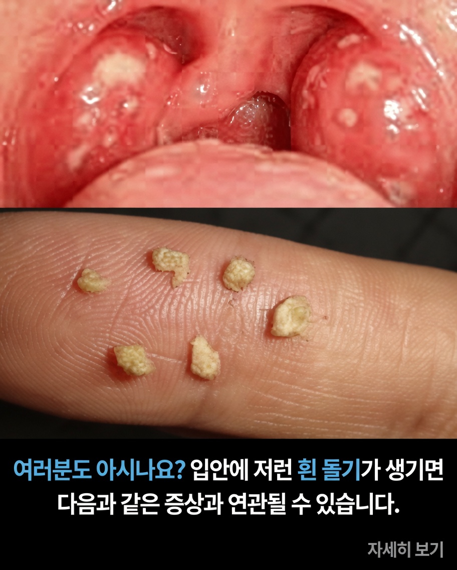 입안의 하얀 돌기가 무엇을 의미할 수 있는지 알아보고 시도해볼 만한 일상 습관들