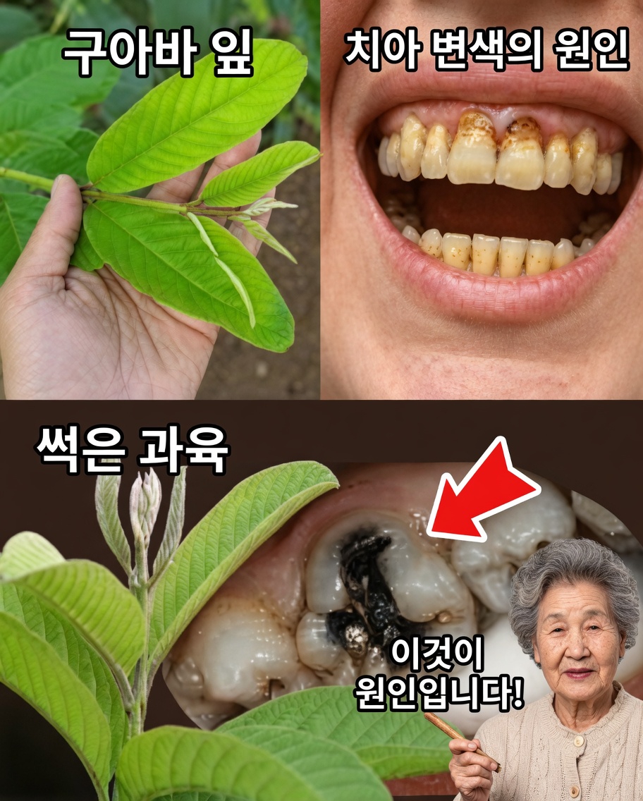 구아바 잎으로 충치를 치료하는 3가지 방법 – 간단하고 비용 효율적임