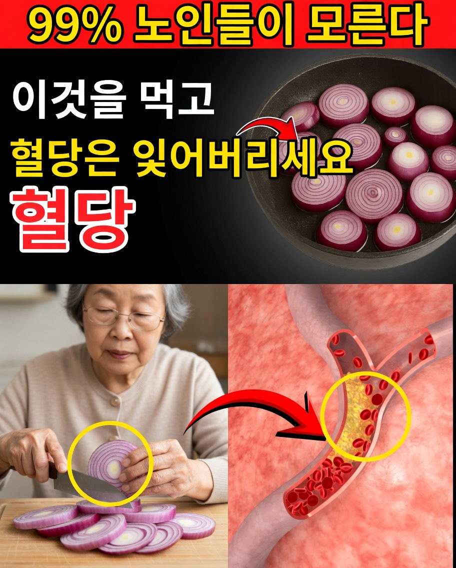 시니어 여러분, 오늘 밤 양파 1개를 썰고 이 60초 만에 만드는 묘약을 홀짝이세요. 그러면 혈당이 28포인트 떨어지고, 동맥이 반짝이게 깨끗해지며, 자는 동안 심장까지 지켜줍니다.
