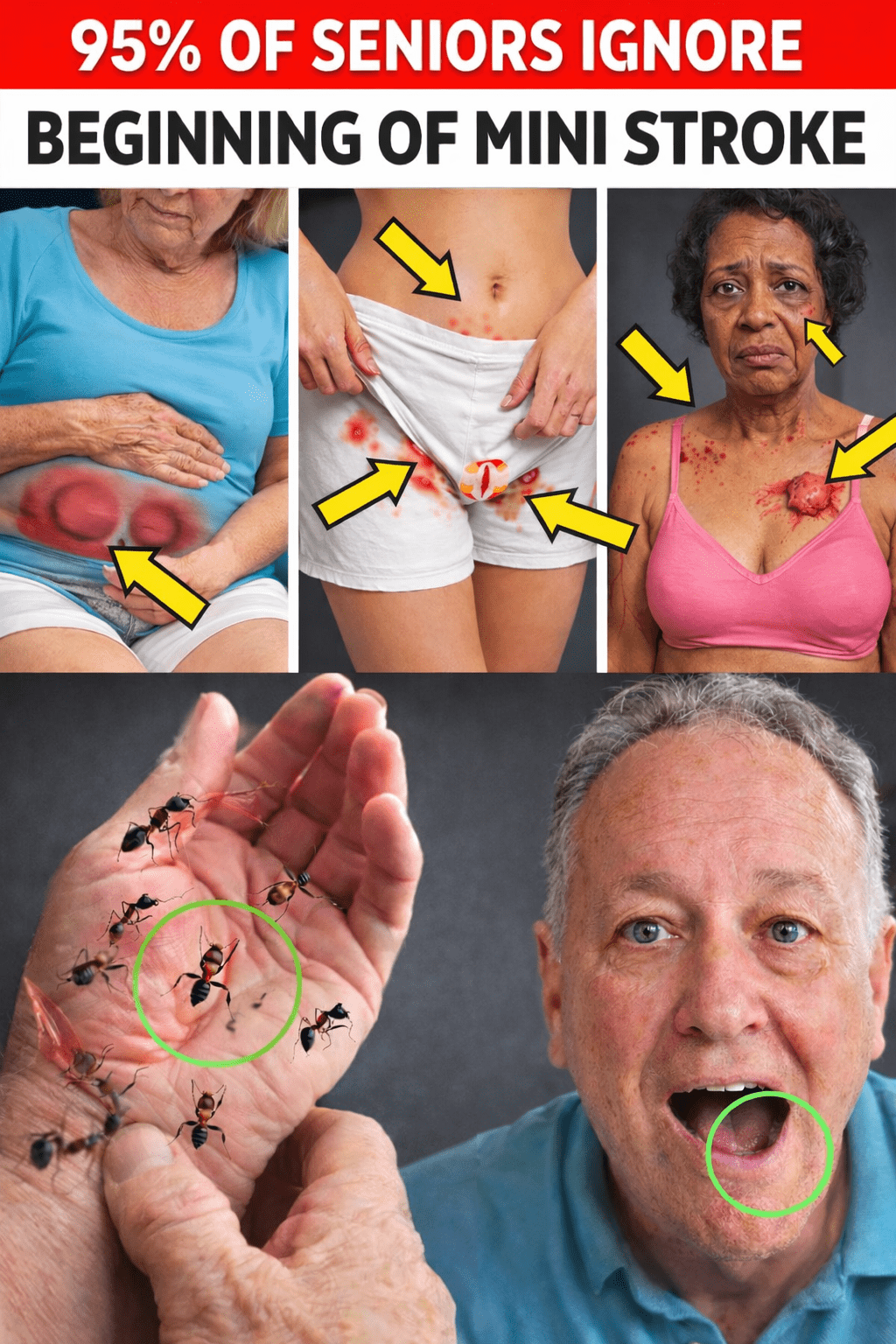 60세 이상이 자주 놓치는 일과성 허혈 발작(TIA)의 미묘한 징후 10가지