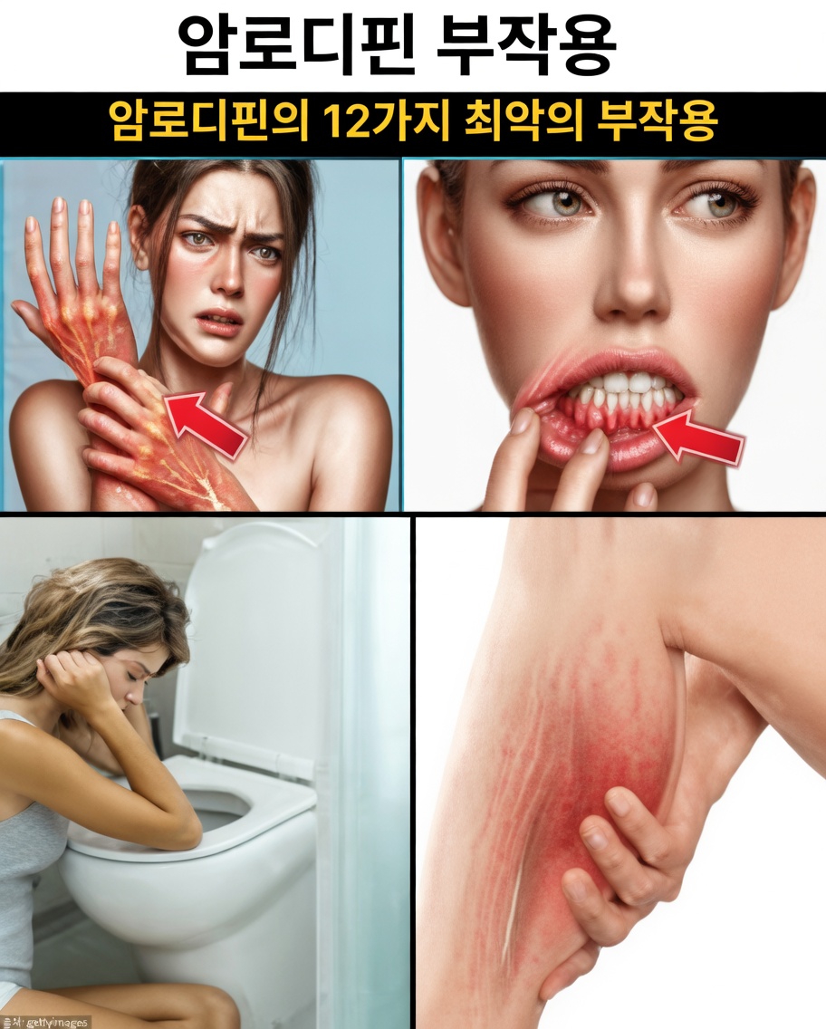 암로디핀의 가장 흔한 부작용은 무엇일까요? 주의해야 할 12가지 사항
