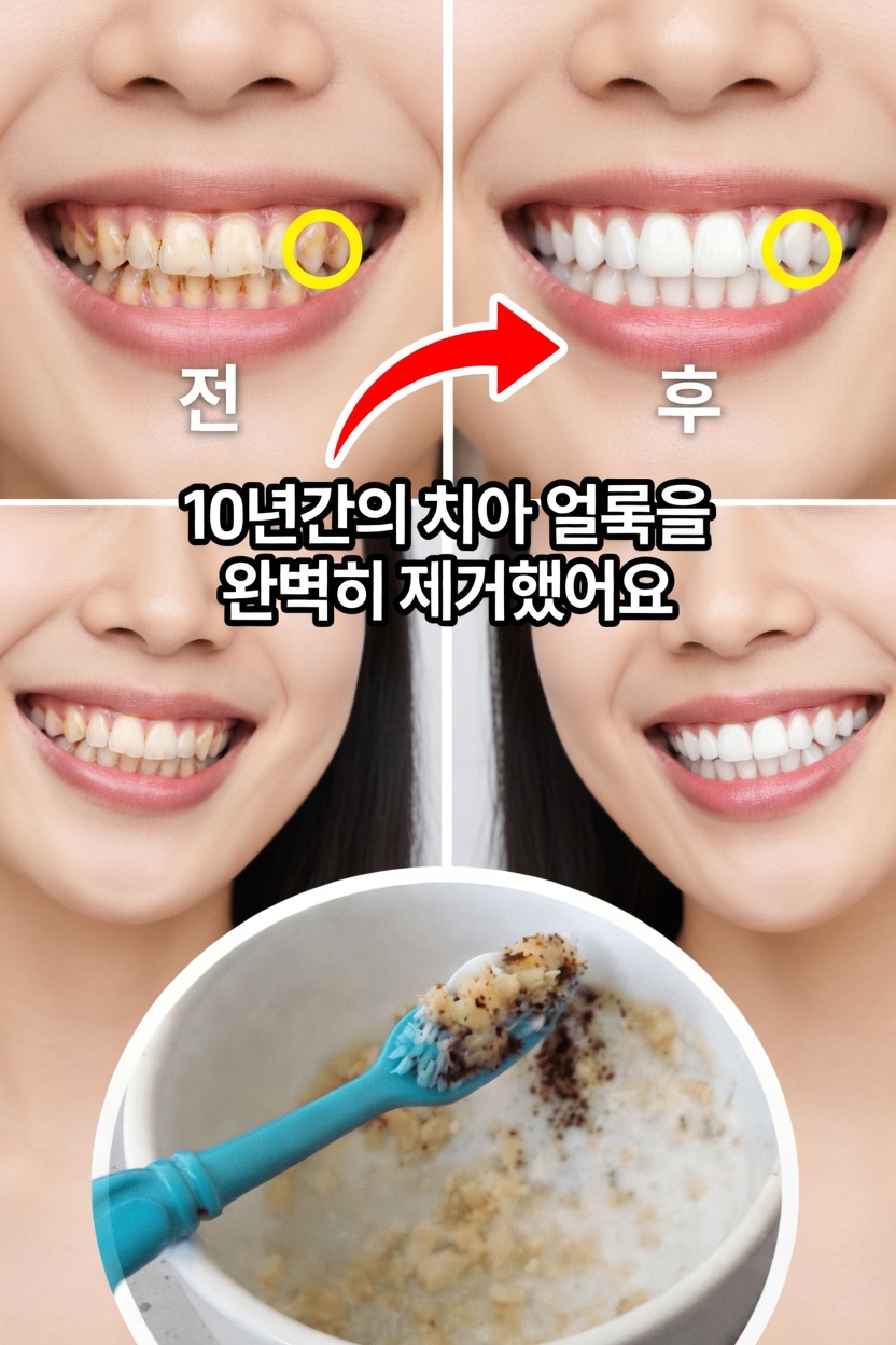 표면 착색이 생기는 이유와 부드러운 연마가 중요한 이유