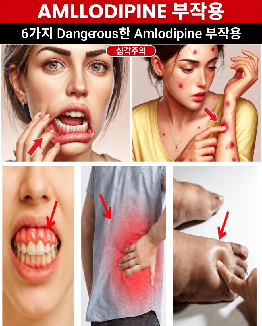 암로디핀의 가장 흔한 부작용은 무엇이며 어떻게 관리할 수 있나요?