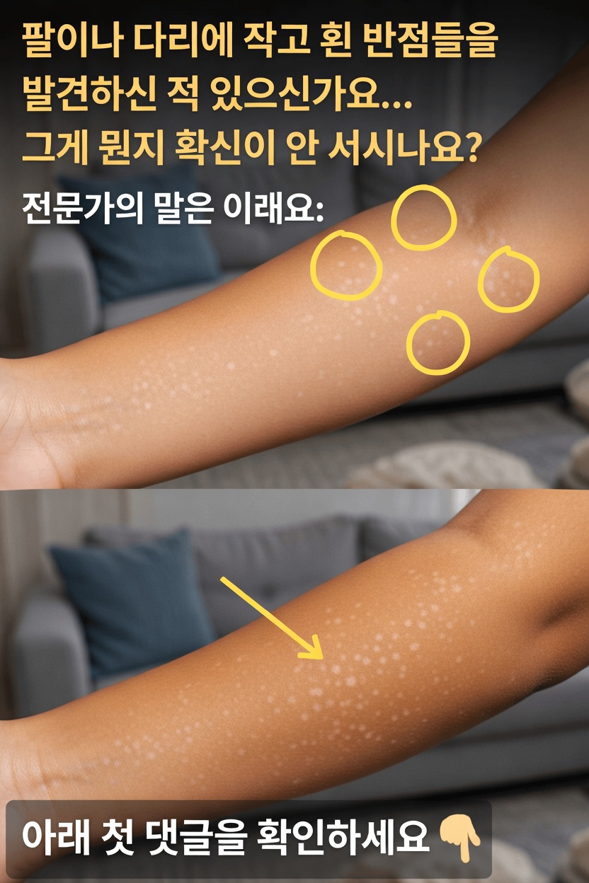 피부의 흰 반점: 원인, 유형 및 의사를 찾아야 할 때