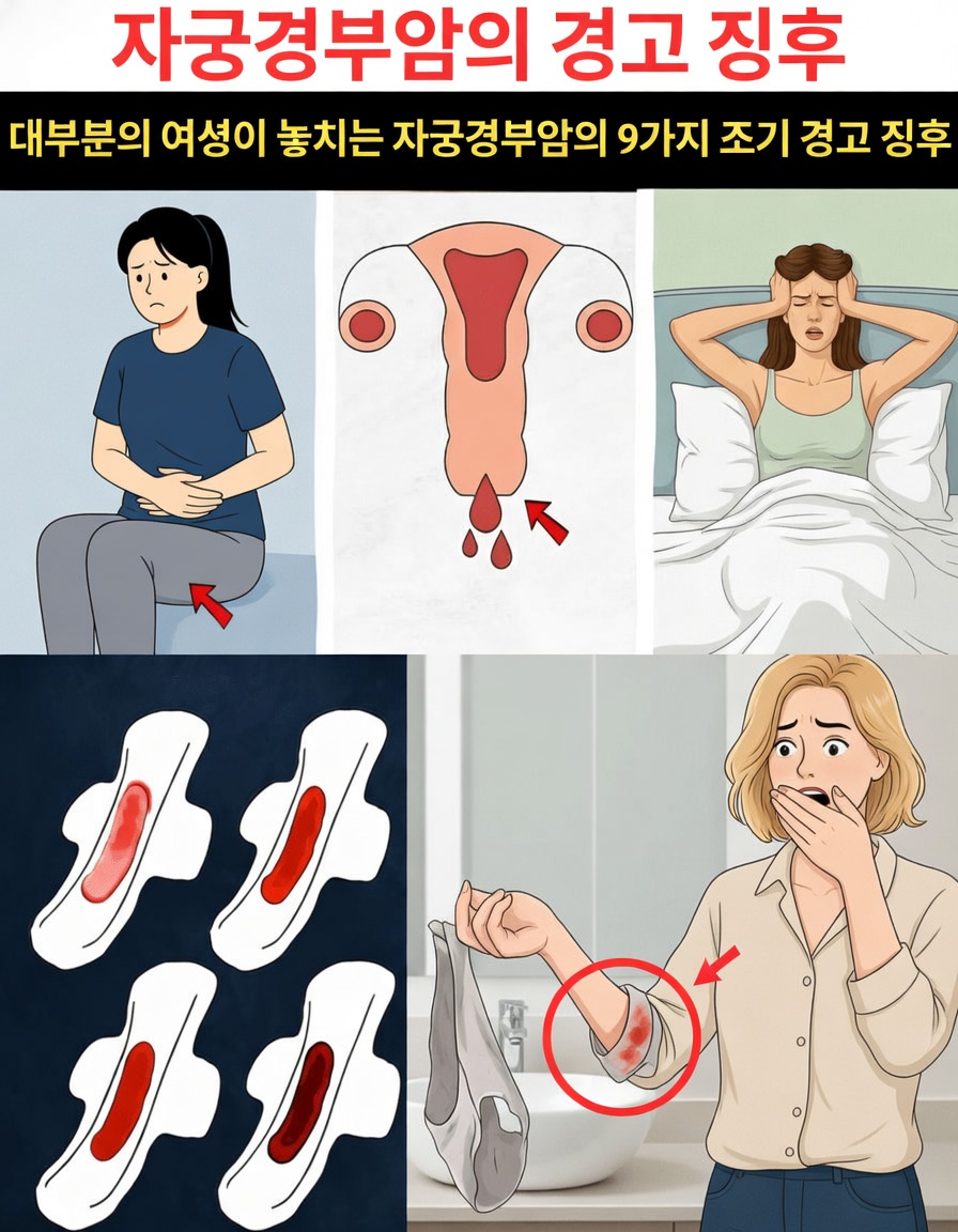 자궁경부암 이해와 조기 인식의 중요성