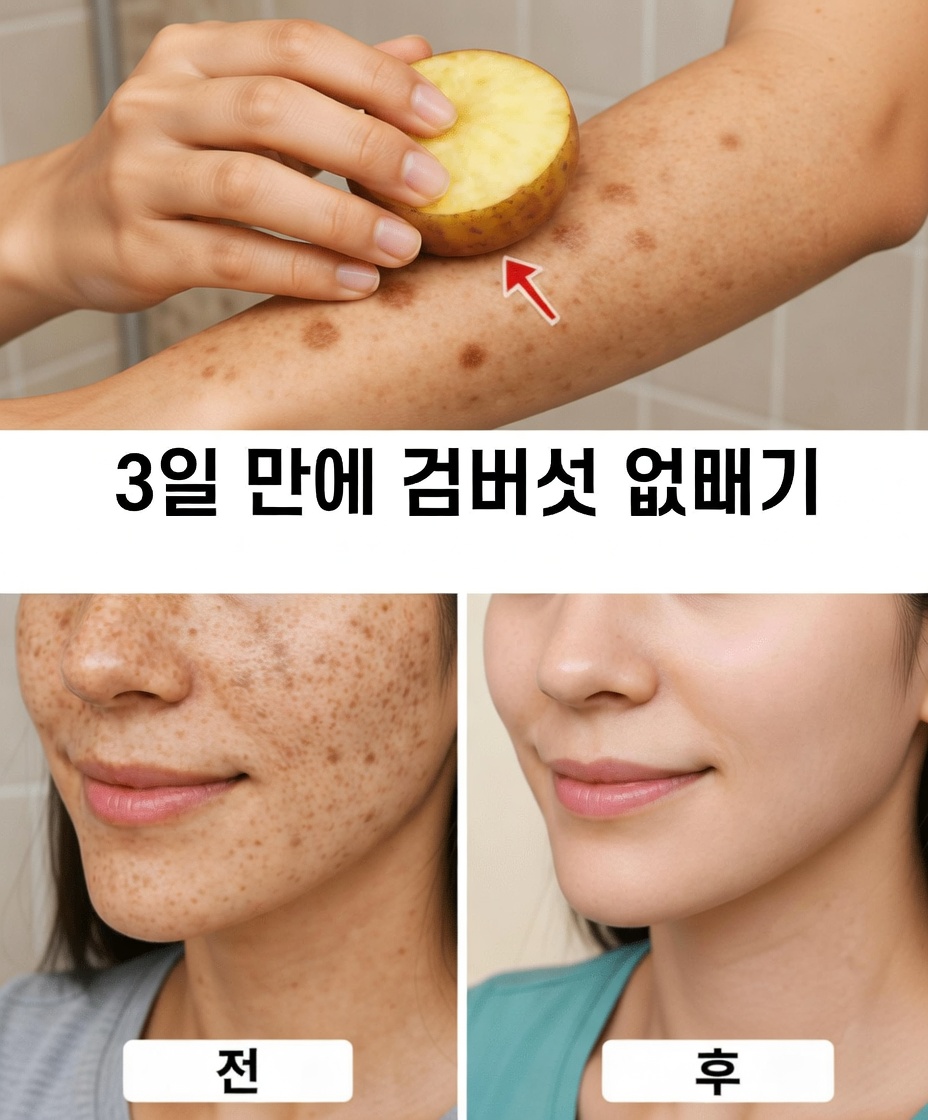 검버섯, 기미, 햇빛 반점, 잡티와 노화 징후를 없애세요.