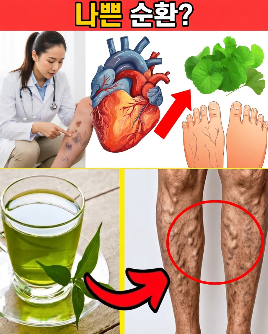 정맥류 불편함을 완화하고 혈액 순환을 개선하는 10가지 자연적인 방법