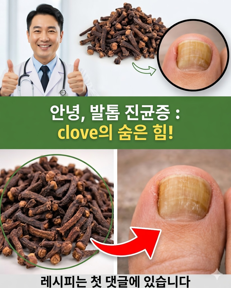 정향으로 손발톱 곰팡이를 없애기: 많은 사람이 선택하는 자연 요법