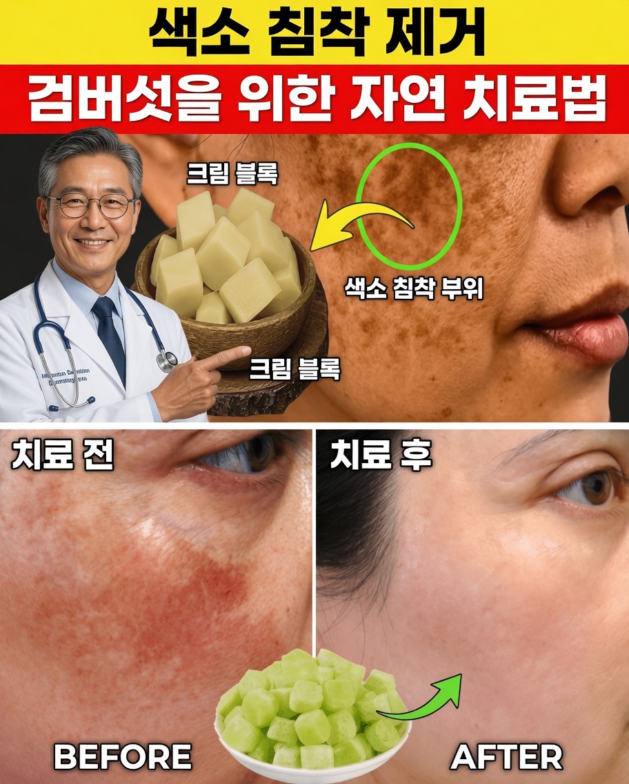 20일 만에 색소침착, 기미 & 어두운 반점을 자연스럽게 없애기 – 빛나는 피부를 위한 순한 루틴