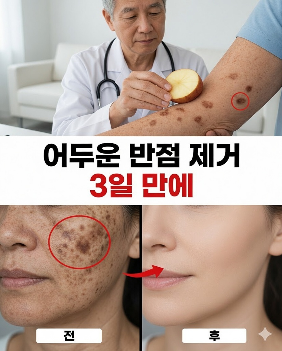 노화 반점, 기미, 햇빛 반점 및 노화 징후를 줄이는 데 도움이 되는 9가지 자연 요법