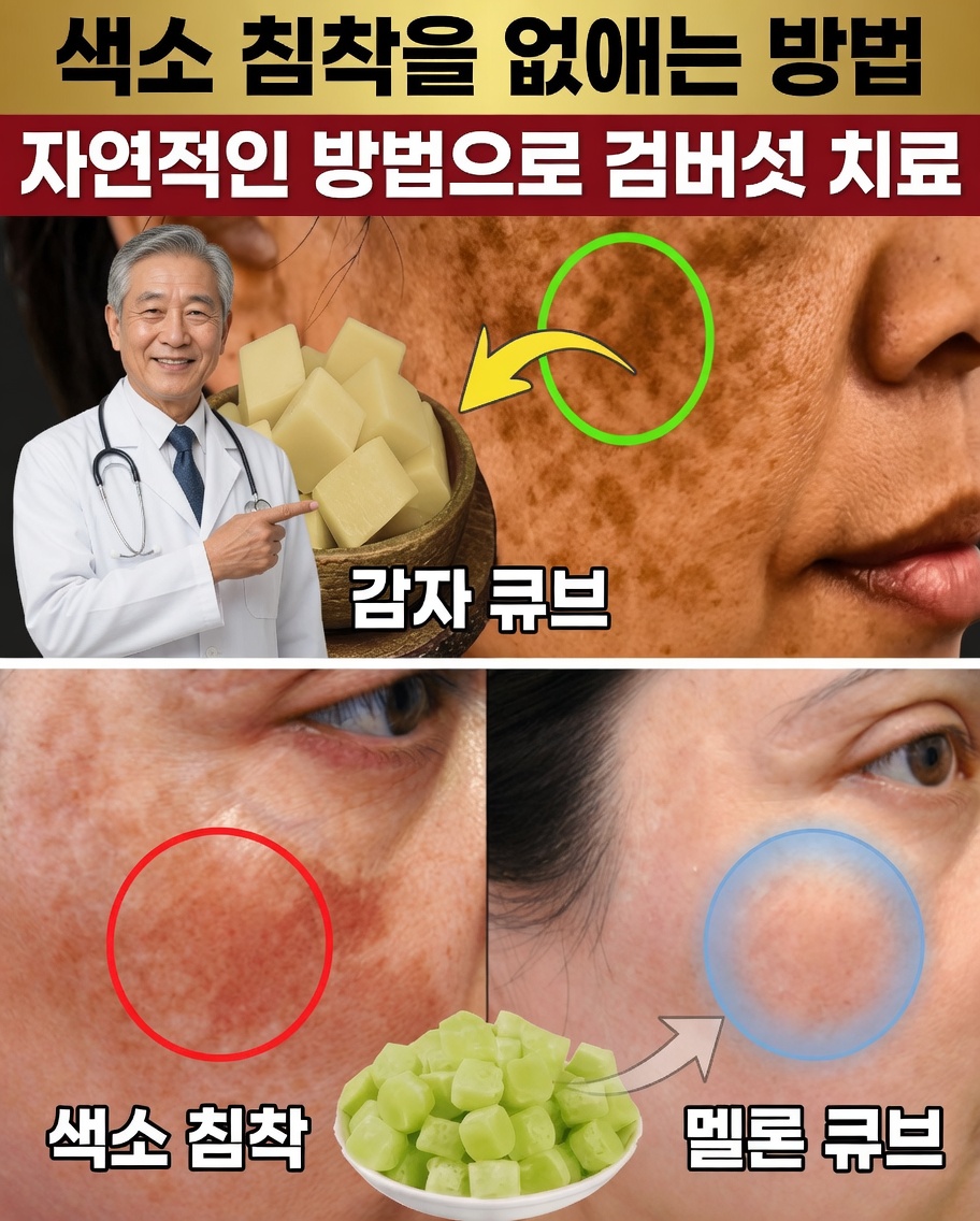 단 20일 만에 색소침착, 기미 & 어두운 반점을 자연스럽게 없애는 법 – 일본의 장수 지혜에서 영감을 받아