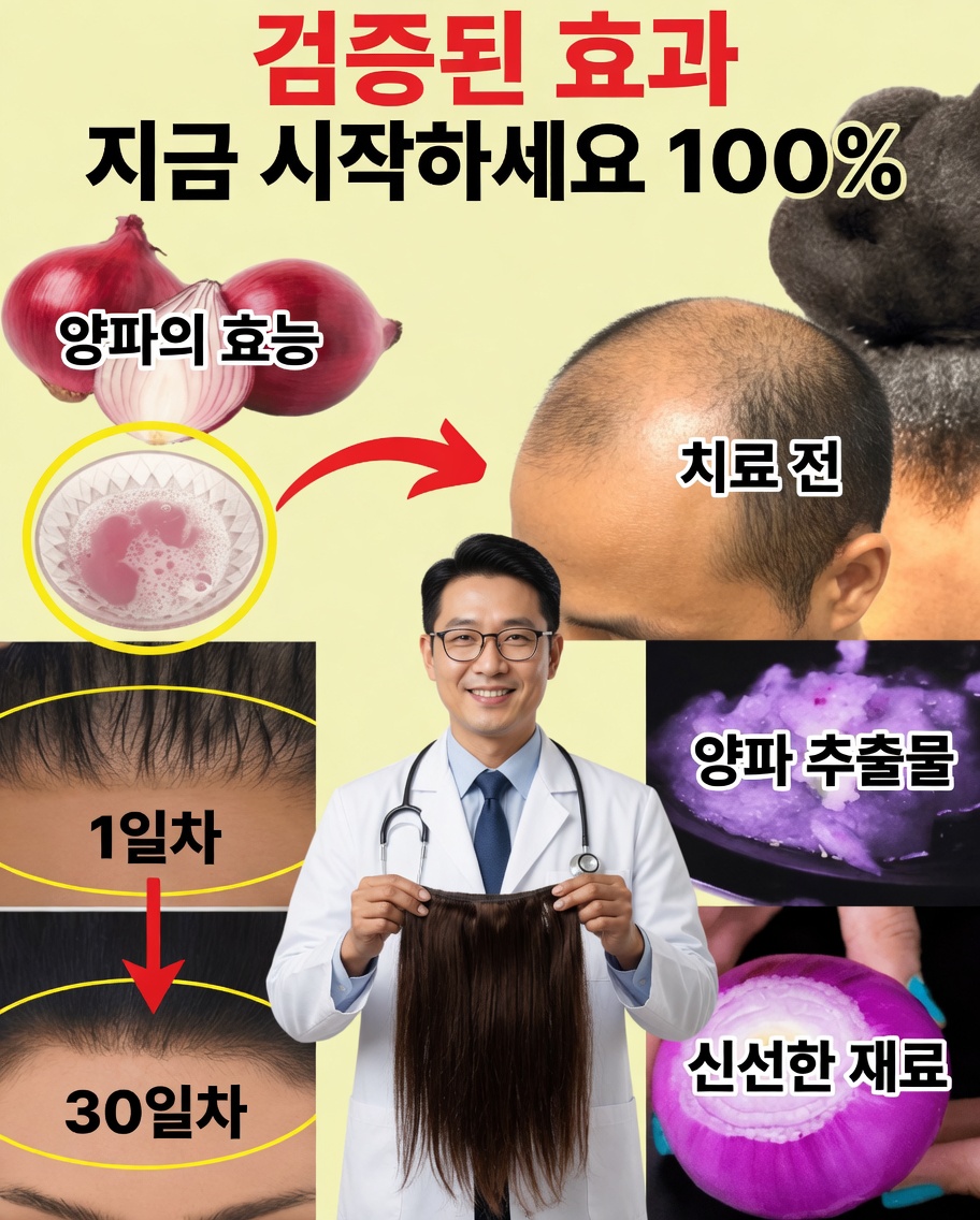 모발 성장을 위한 양파 오일: 정말 효과가 있는 간단한 천연 요법