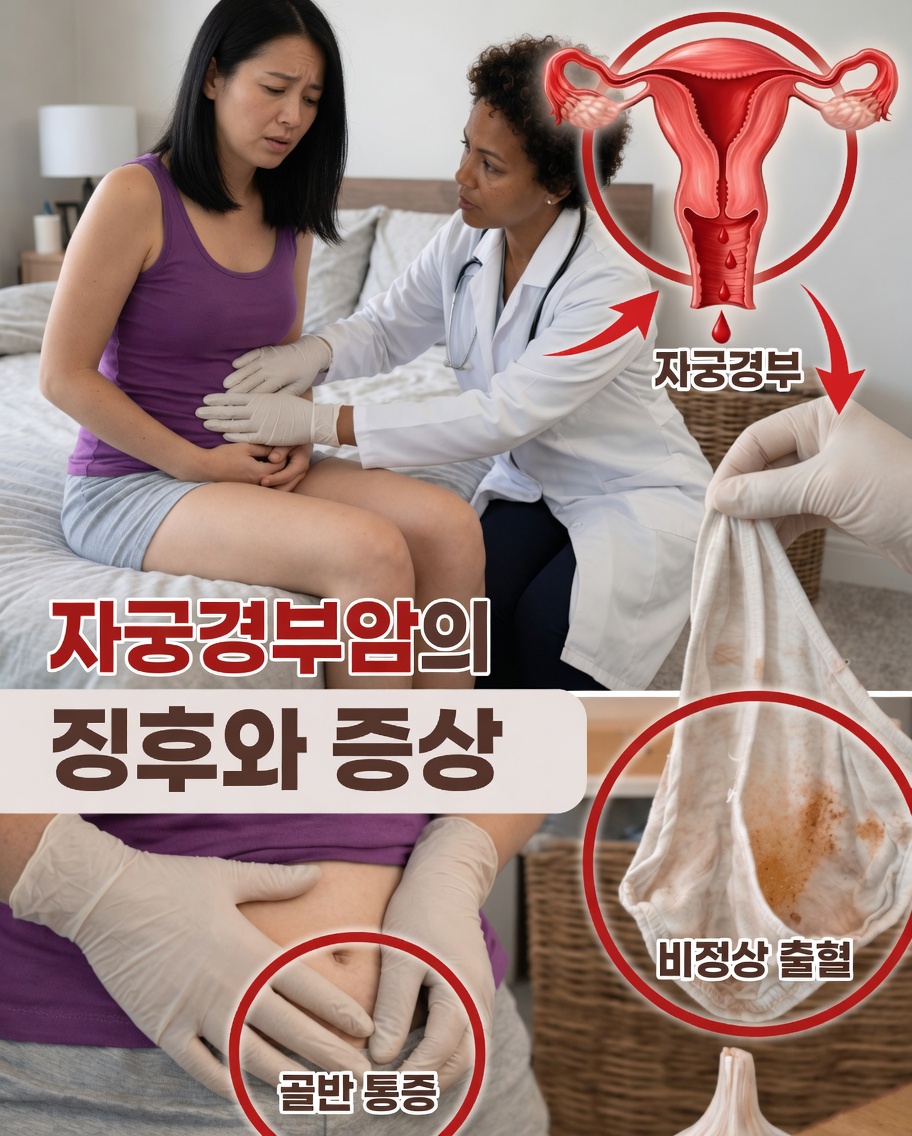 많은 여성이 무시하는 자궁경부암의 9가지 초기 신호 – 이 증상들을 무시하지 마세요