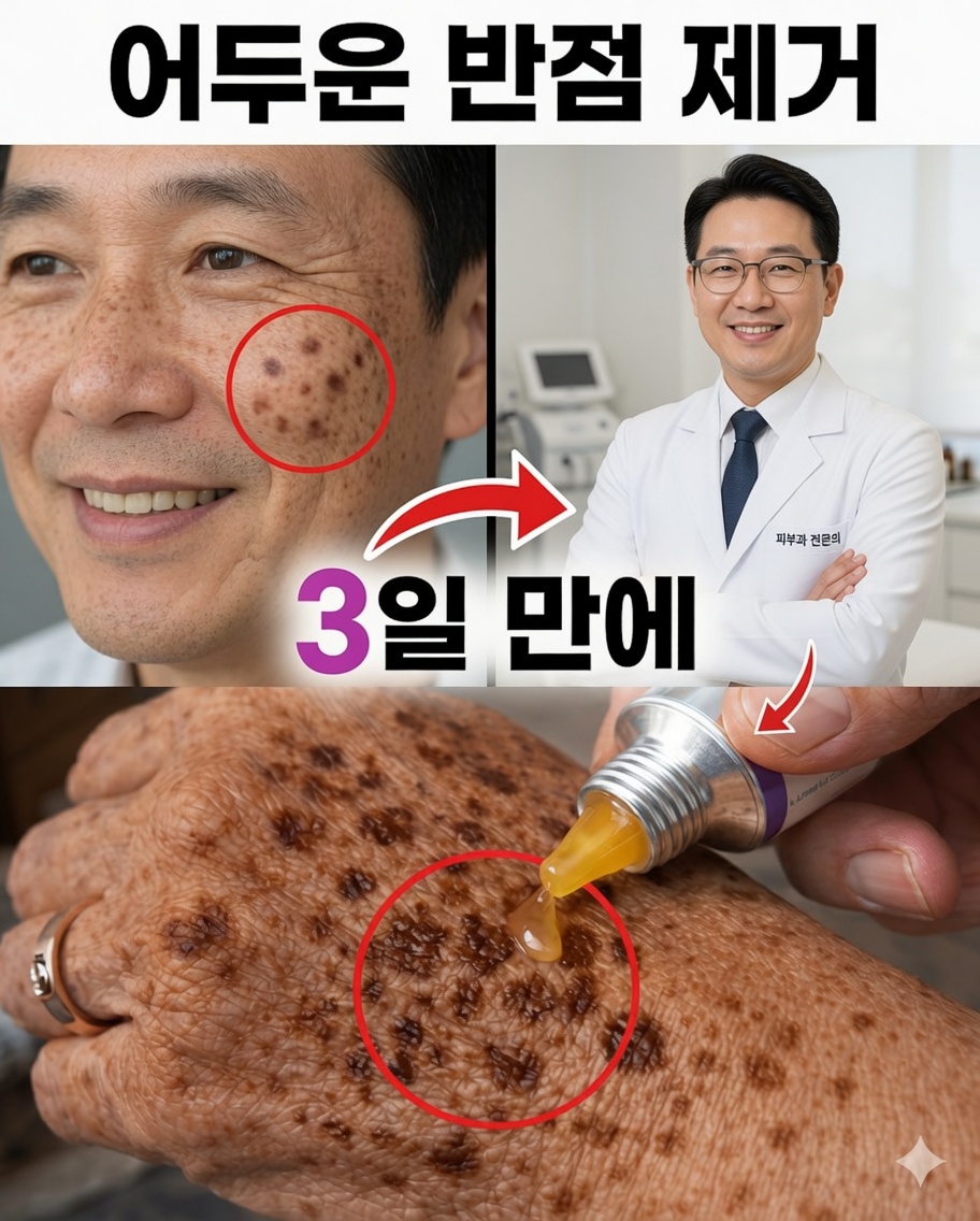 자연스럽게 기미와 검버섯을 없애세요: 더 밝고 균일한 피부를 위한 옥수수전분, 베이킹소다, 레몬의 간단한 마스크
