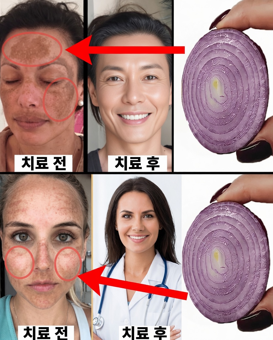 옥수수전분과 양파를 섞어 눈처럼 하얗고 유리처럼 맑은 피부를: 더 일찍 알았더라면 좋았을 자연의 비밀