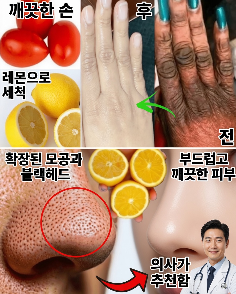 얼굴을 더 젊고 빛나게 만드는 레몬 뷰티 레시피 5가지