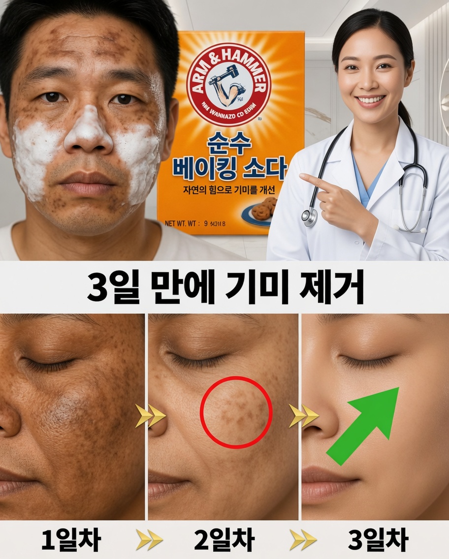 베이킹소다 홈메이드 크림: 주름과 검은 반점에 작별을 고하세요