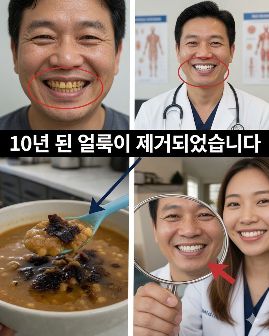 2분 만에 치아 얼룩 10년치를 제거할 수 있을까? 당신을 놀라게 할 진실
