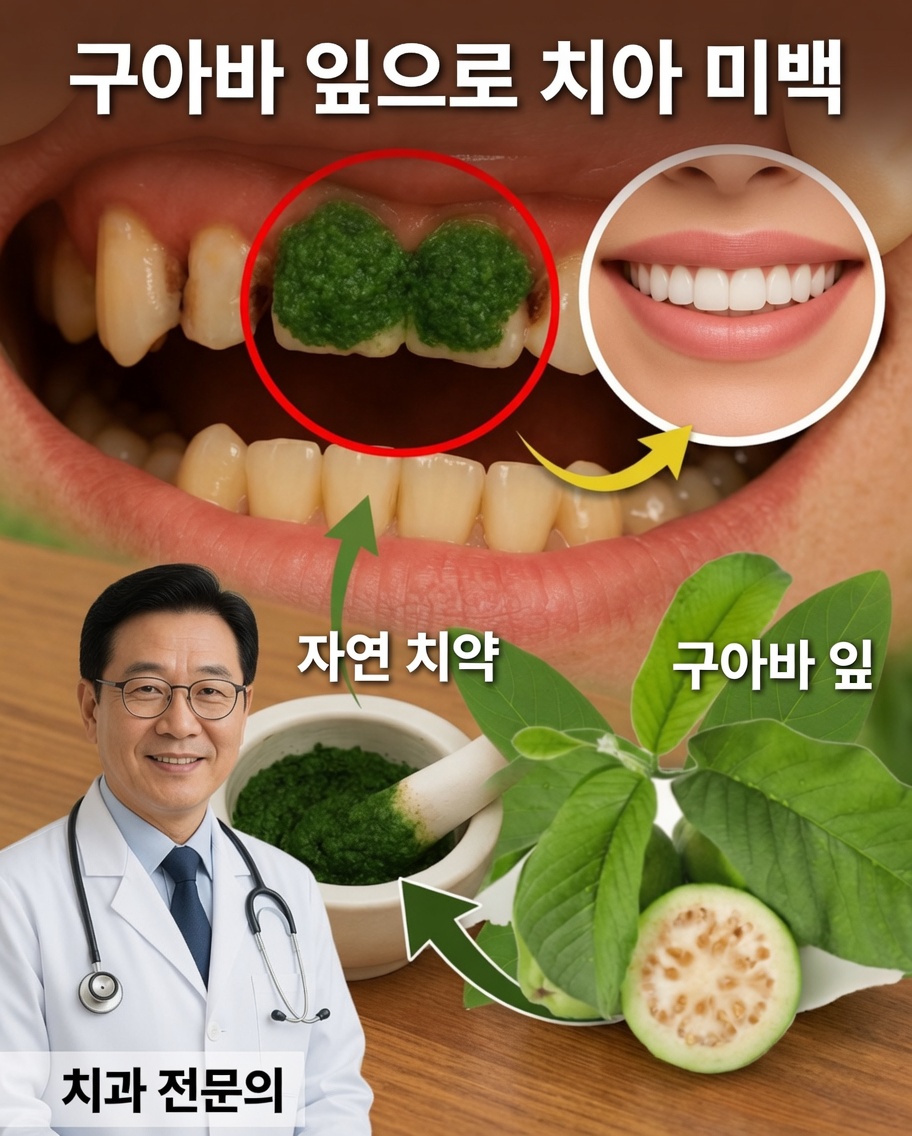 Folhas de Goiaba Combatem a Cárie Dentária de 3 Maneiras Poderosas