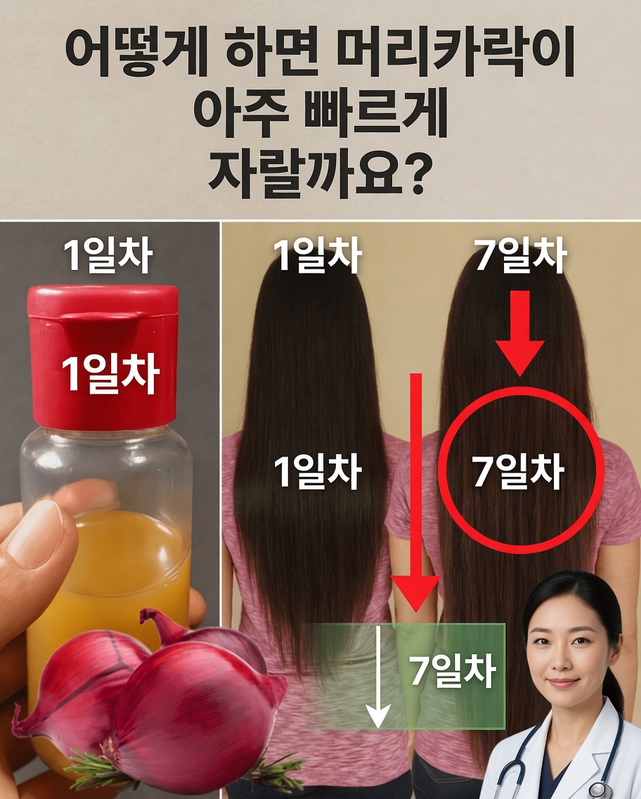 빠른 모발 성장을 위한 양파 오일 만드는 방법과 탈모 멈추기