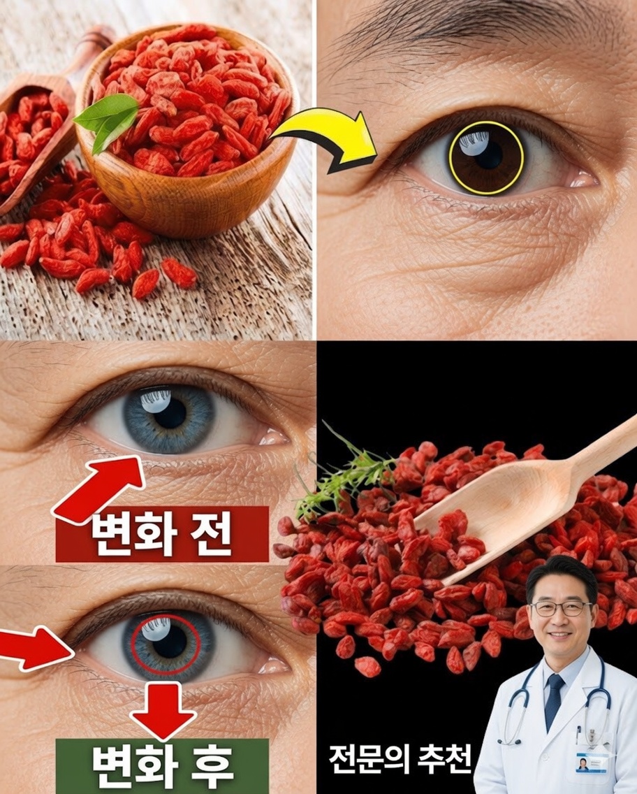 50세 이후 백내장과 흐릿한 시야? 더 맑은 눈을 자연스럽게 돕기 위해 이 간단한 과일을 매일 드세요