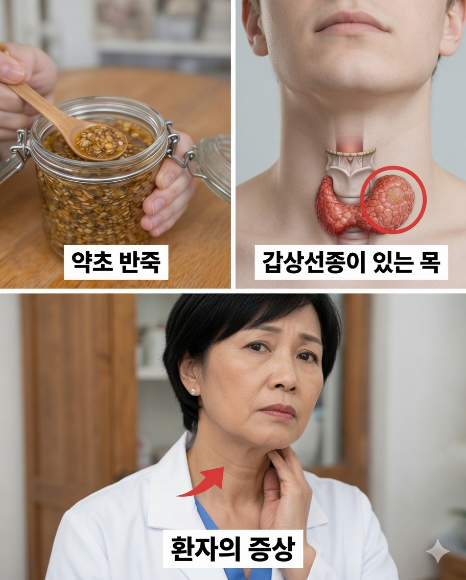 이 혼합물 한 스푼은 매우 귀중할 수 있습니다 – 간단한 수제 조제법이 갑상선 건강을 지원하는 데 어떻게 도움이 될 수 있는지