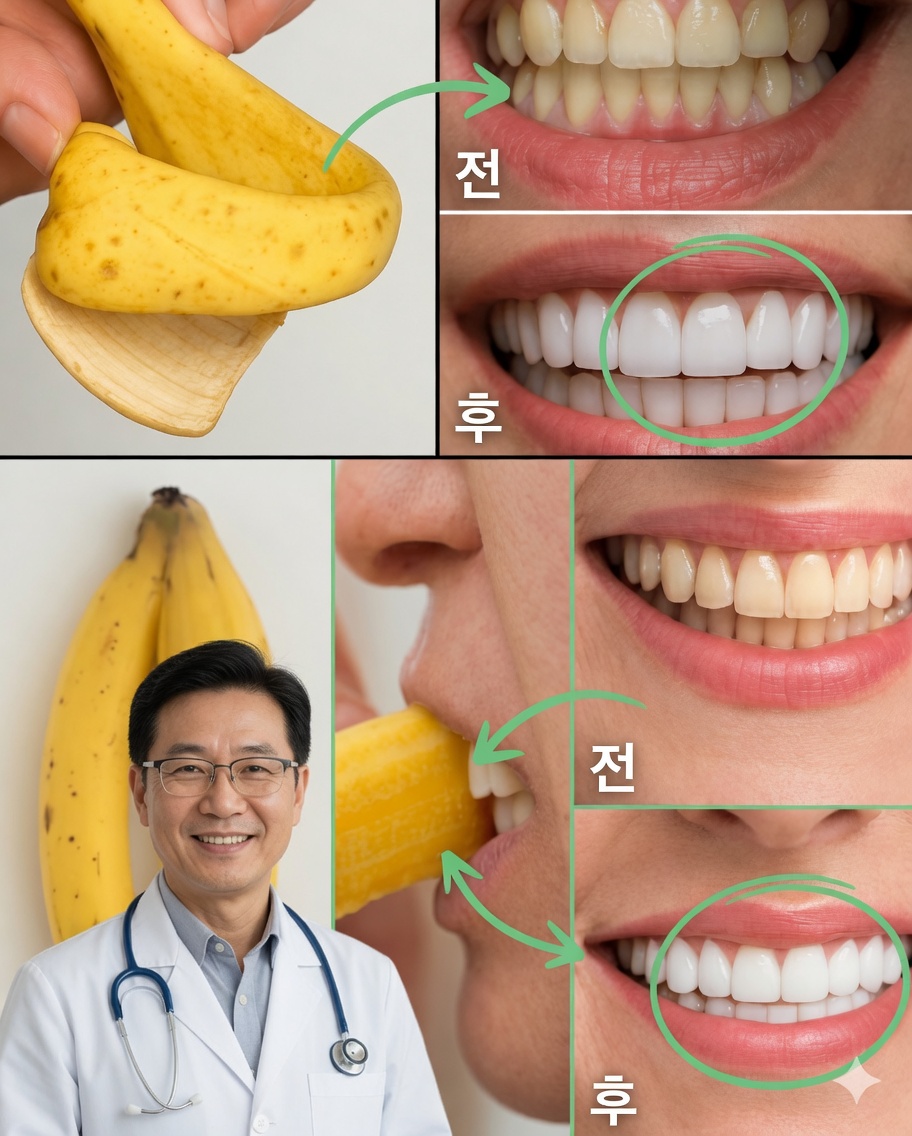 바나나 껍질로 단 2분 만에 미소를 밝혀보세요