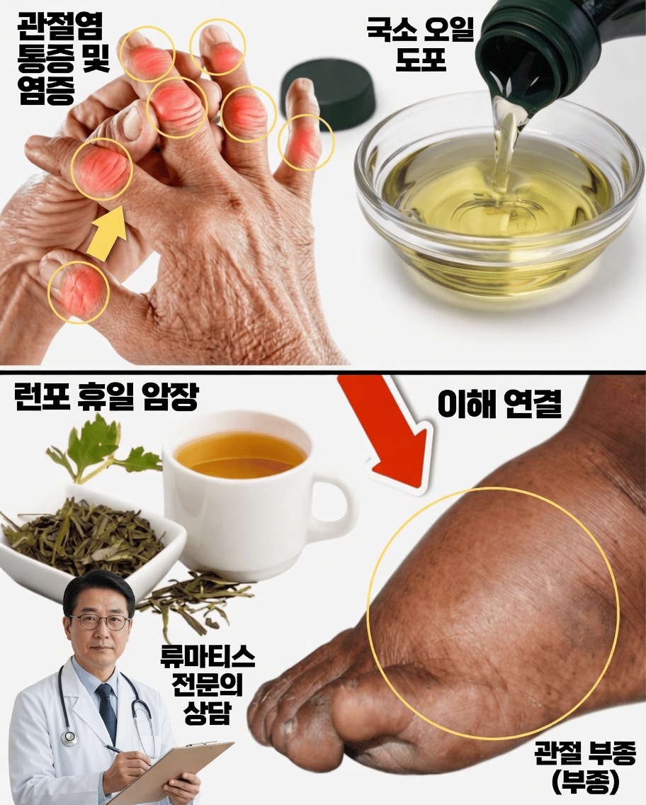 이 허브차를 마시고 다리, 발목, 발의 부기와 작별하세요