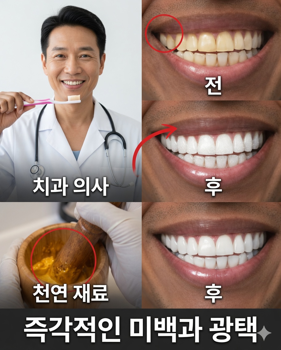집에서 자연스럽게 누렇게 변한 치아를 하얗게 만드는 방법: 주목받고 있는 바나나·생강·레몬의 강력한 비밀