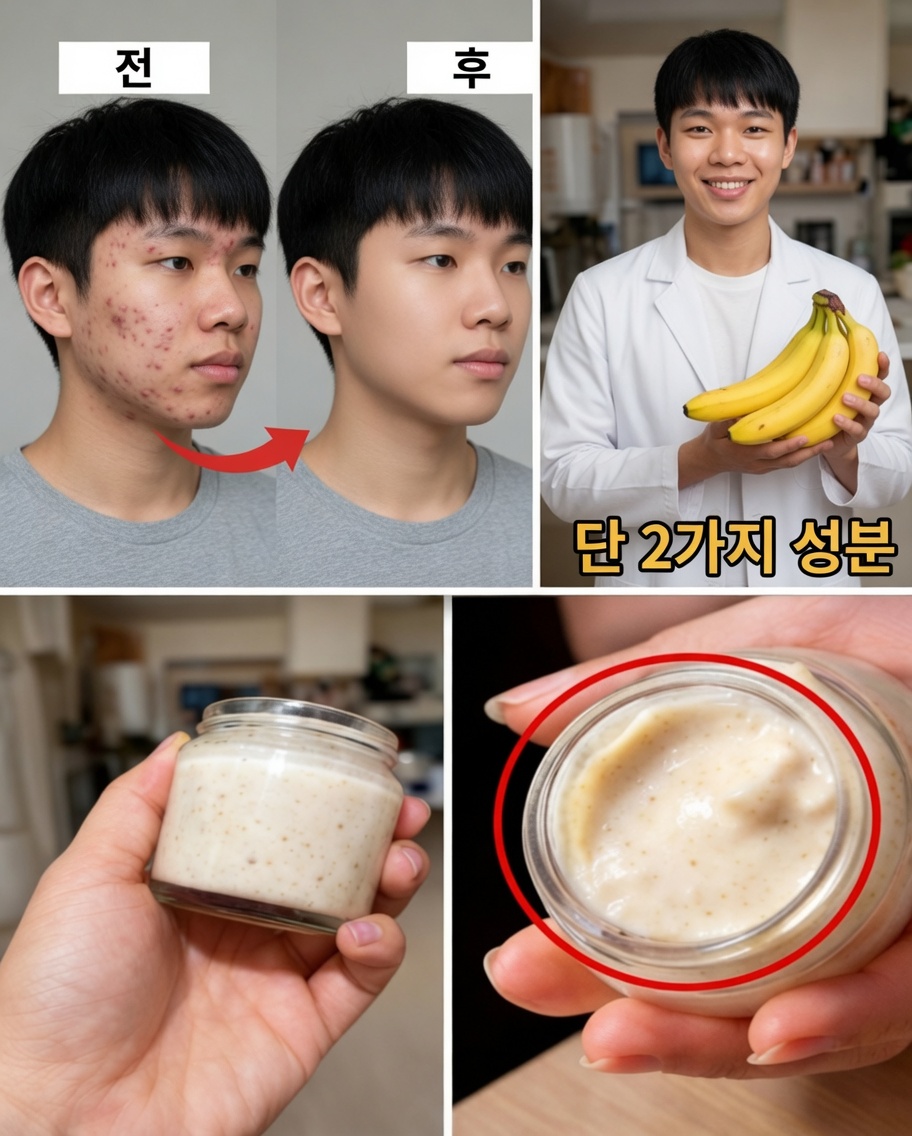 7가지 자연적인 방법으로 바나나 껍질을 사용해 잔주름을 완화하고 피부를 환하게 밝히는 법