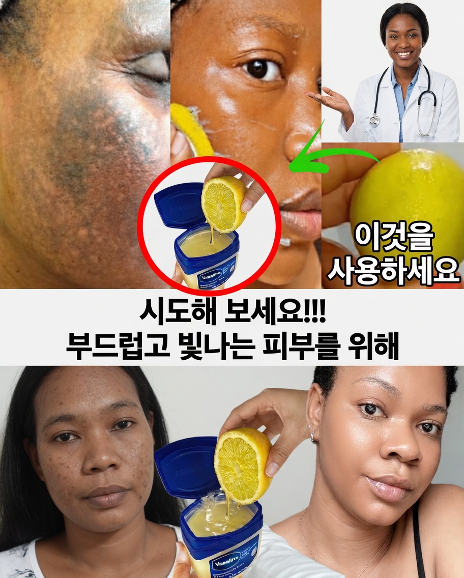 바셀린과 레몬으로 더 밝고 부드러운 피부 만들기