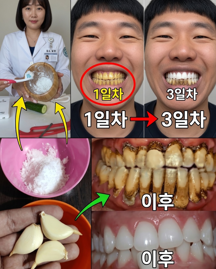 전례 없이 웃어라: 집에서 눈부신 미소를 위한 비밀을 발견하세요