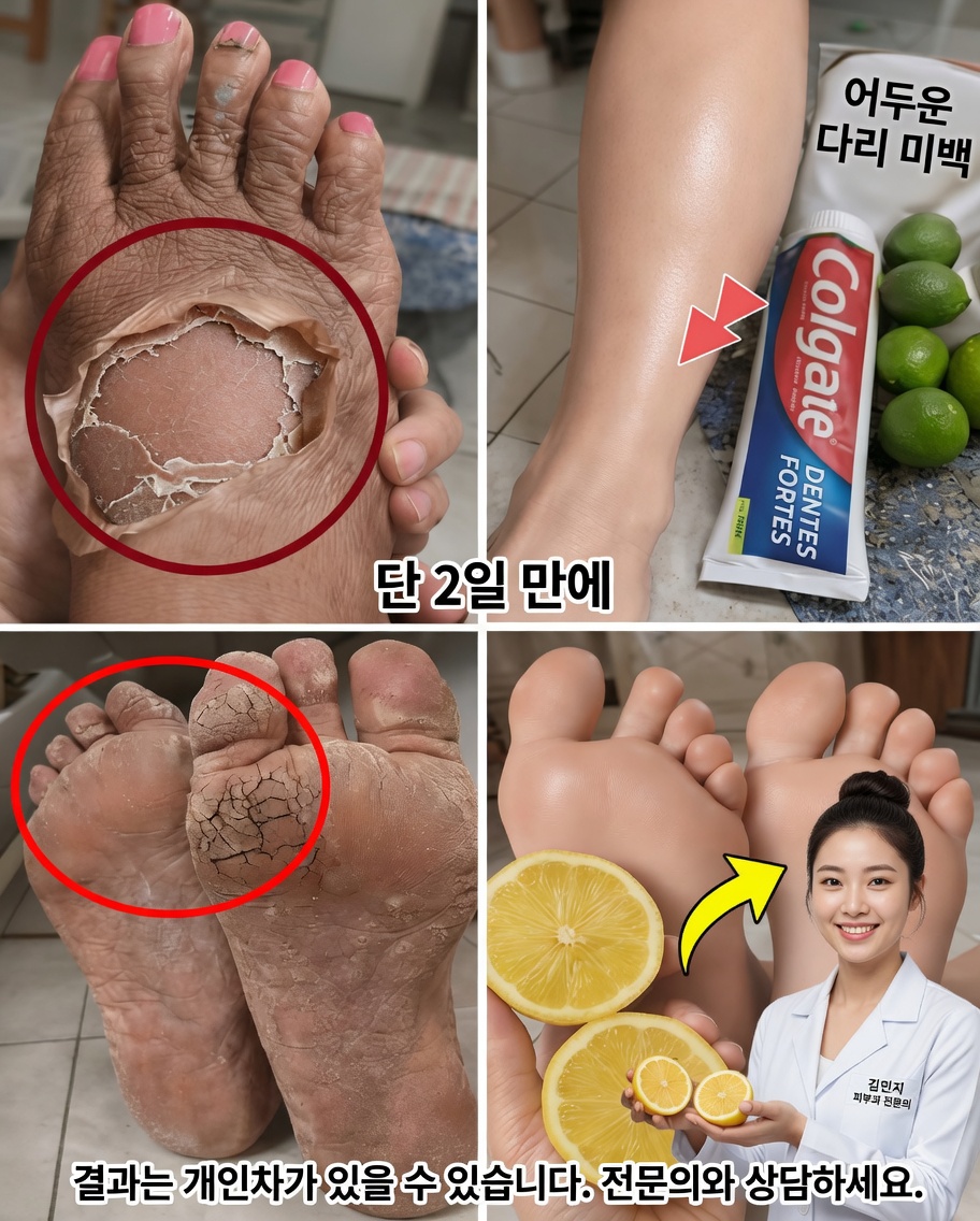 더 매끄럽고 빛나며 건강한 피부를 위해 내 다리 피부의 외관을 개선해준 간단한 일상 습관들