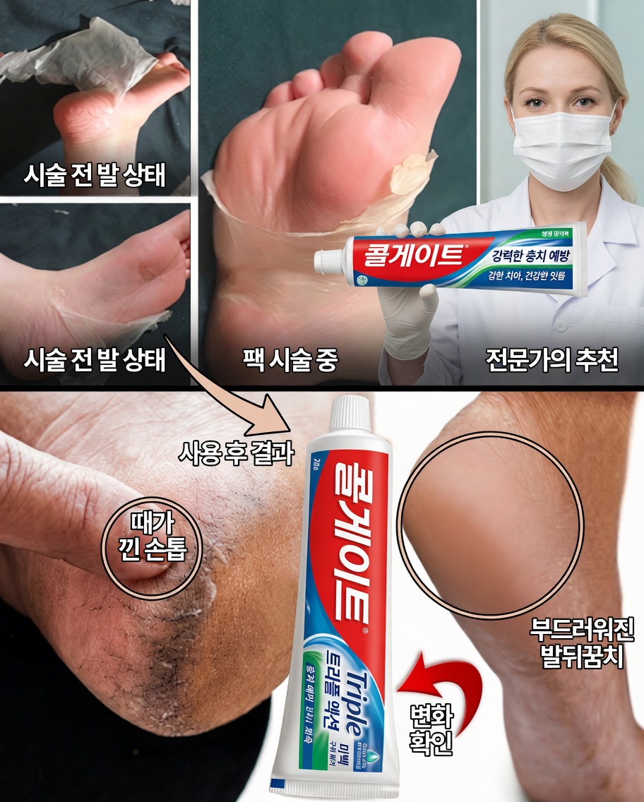 콜게이트 발 관리 비법: 더 부드럽고 건강한 발을 위한 간단한 방법