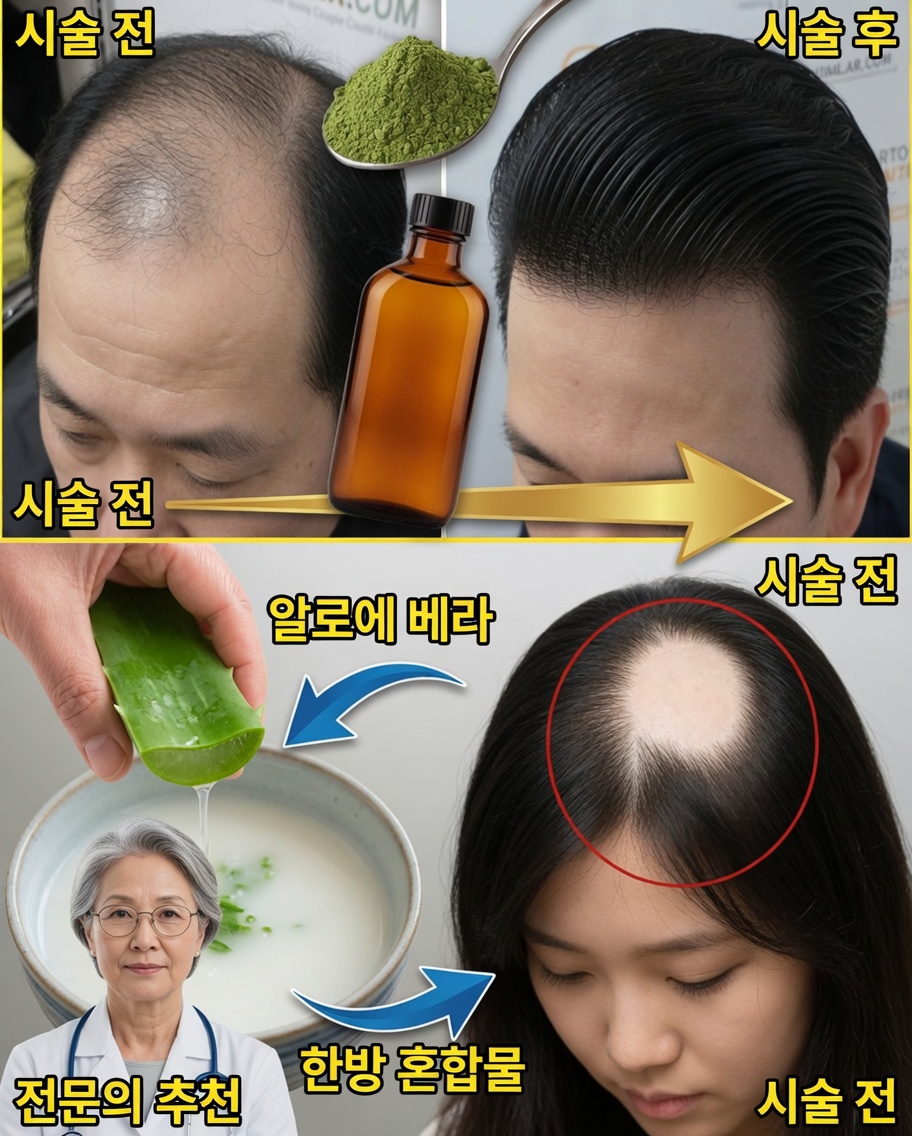 샴푸에 이 간단한 재료를 추가하고 머리카락이 더 굵고, 더 강하고, 더 건강해지는 것을 지켜보세요