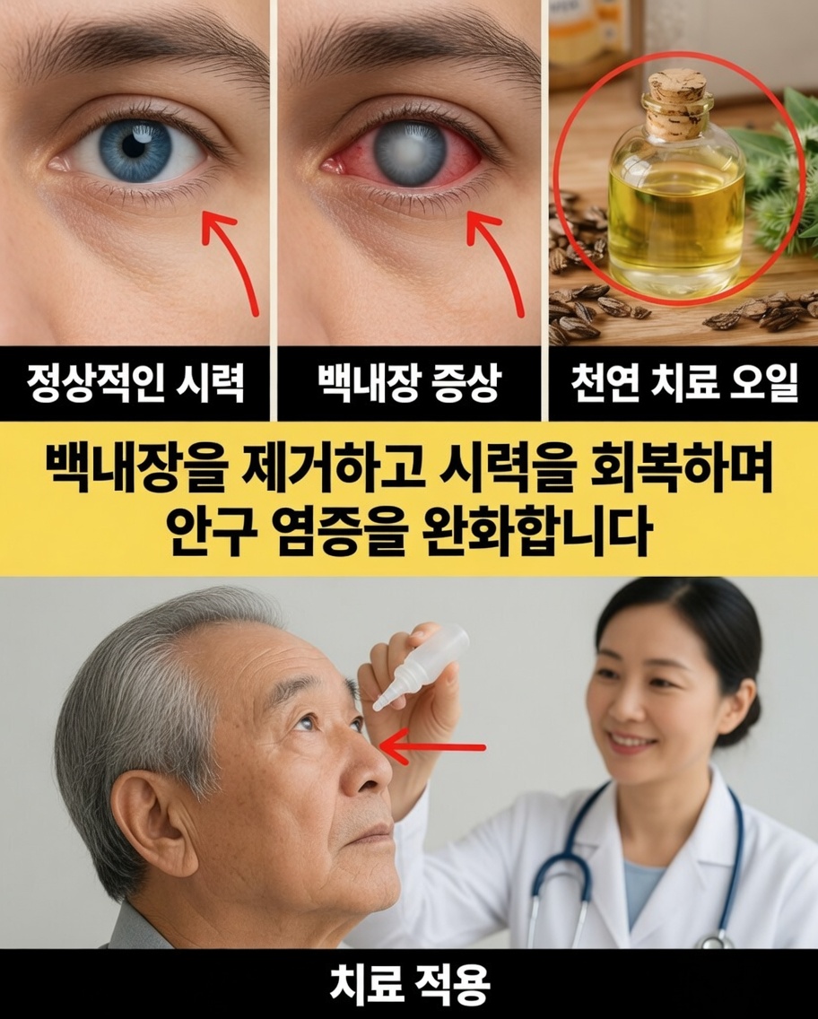 눈 건강을 지원하는 자연 요법: 백내장과 염증을 위한 부드러운 접근법