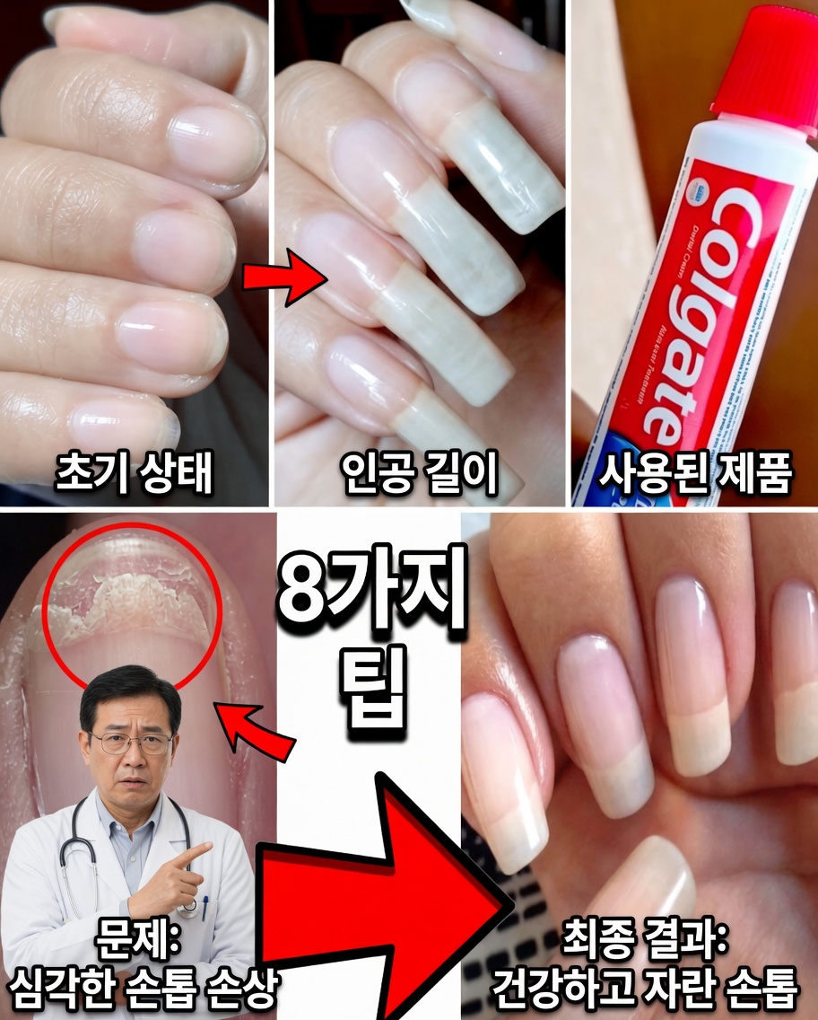 약해진 손톱을 자연스럽게 되살리기: 더 강하고 건강한 손톱을 위한 강력한 마늘 비밀