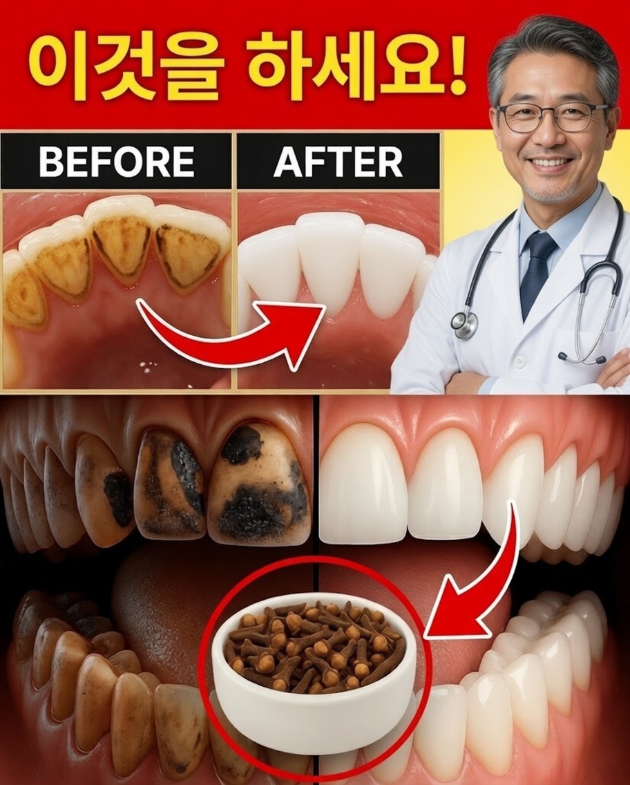 Placa e tártaro를 자연스럽게 제거하는 것으로 입증된 9가지 가정요법