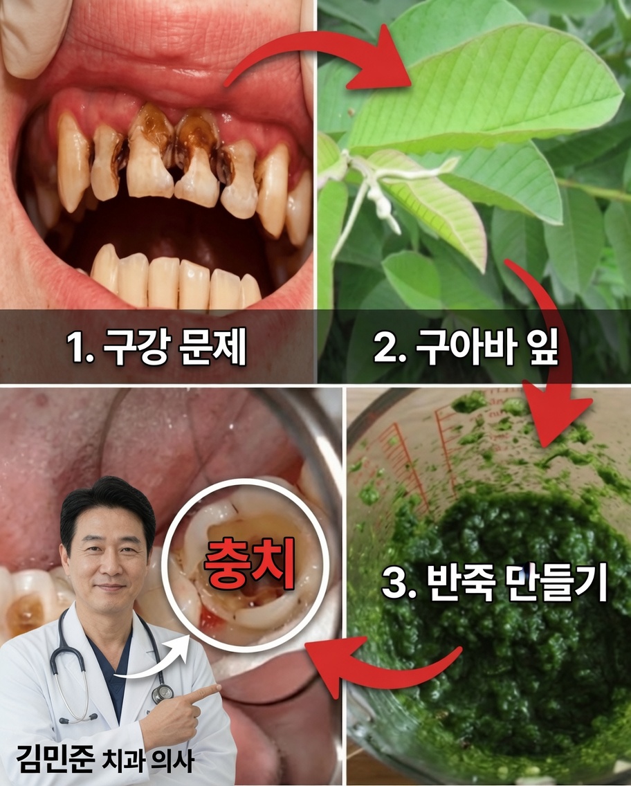 환한 미소를 위한 구아바 잎: 70세 할머니가 전해준 천연 구강 관리 비법