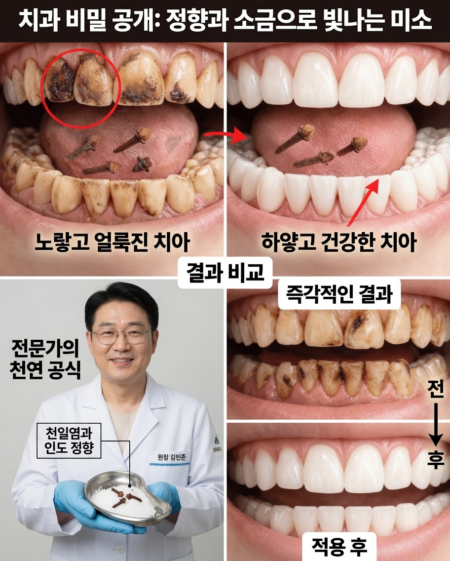 플라크와 치석을 줄이는 데 도움이 되는 9가지 자연 요법 – 더 밝은 미소를 위한 집에서 할 수 있는 부드러운 전략