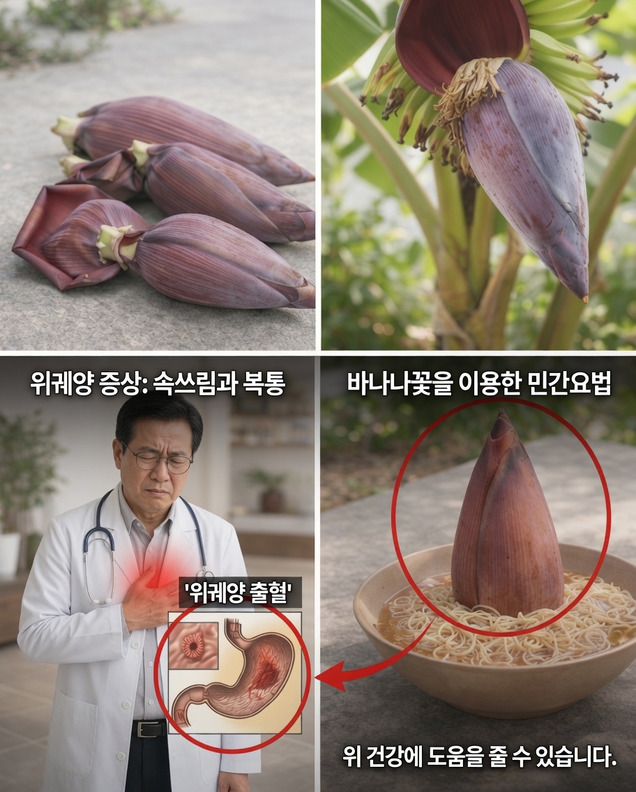 건강을 위해 꼭 알아야 할 바나나꽃의 놀라운 7가지 효능