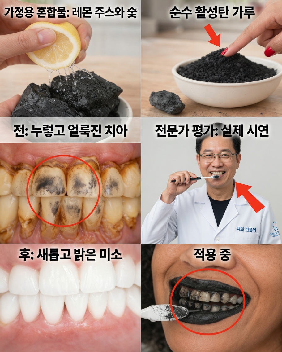 치아를 안전하게 하얗게 만드는 방법: 숯과 레몬에 대한 진실(그리고 실제로 효과적인 것)